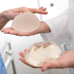 How long do breast implants last
